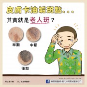 皮膚卡油垢斑點其實就是老人斑/文：洪啟偉醫師