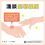 淺談腱鞘囊腫／文：王世杰醫師